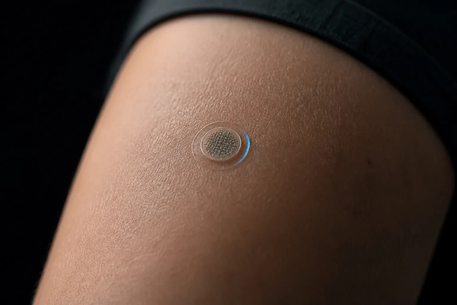 Close-up of a tiny upper-arm microneedle biosensor patch.